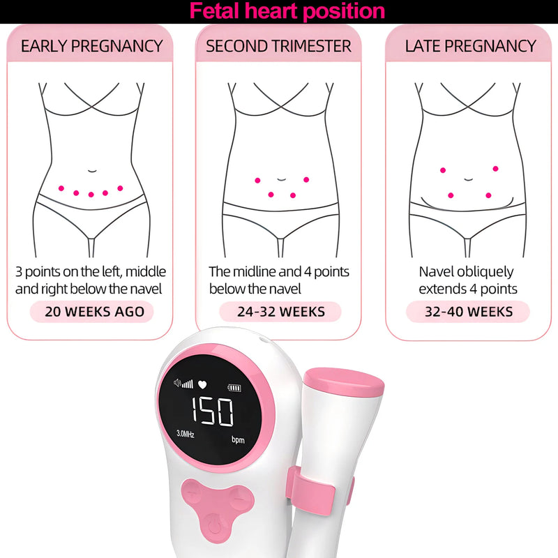 Bloom Fetal Doppler – Baby Heart Rate Monitor 3.0MHz